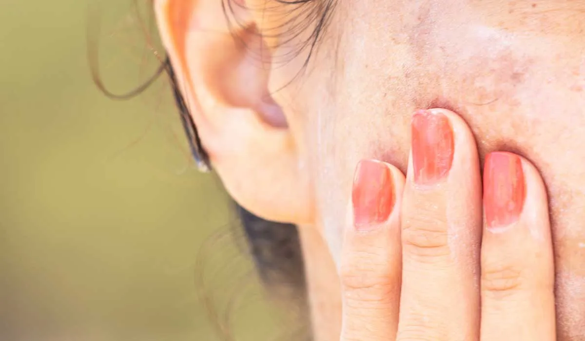 cómo evitar las manchas de la piel