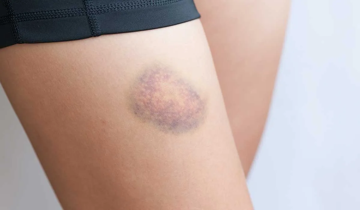 signos de que la menopausia ya viene