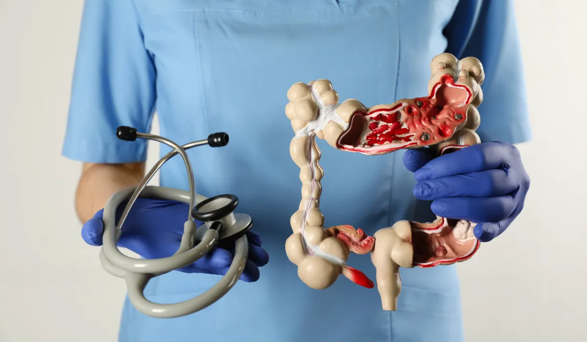 Alimentos que ayudan a prevenir el cáncer de colon