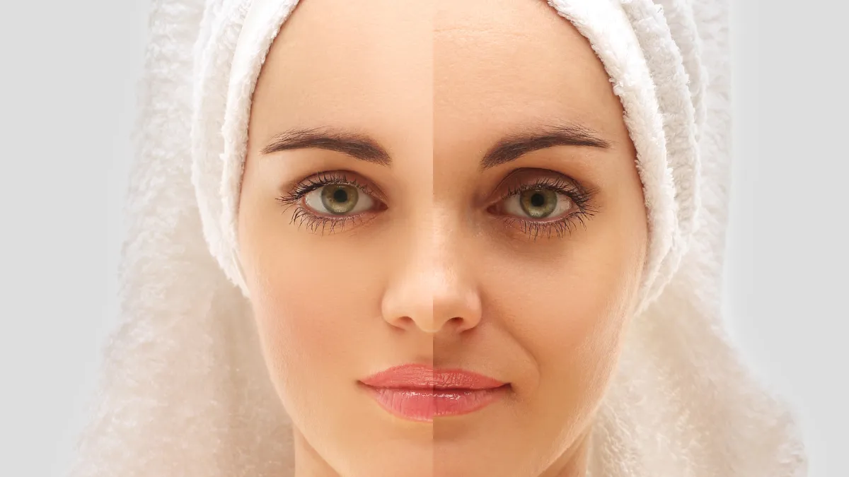 ENVEJECIMIENTO FACIAL