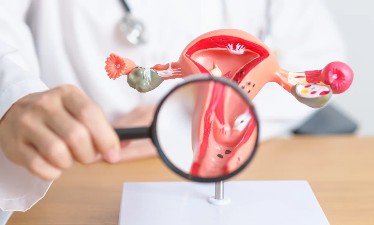 prueba contra cáncer cervicouterino,