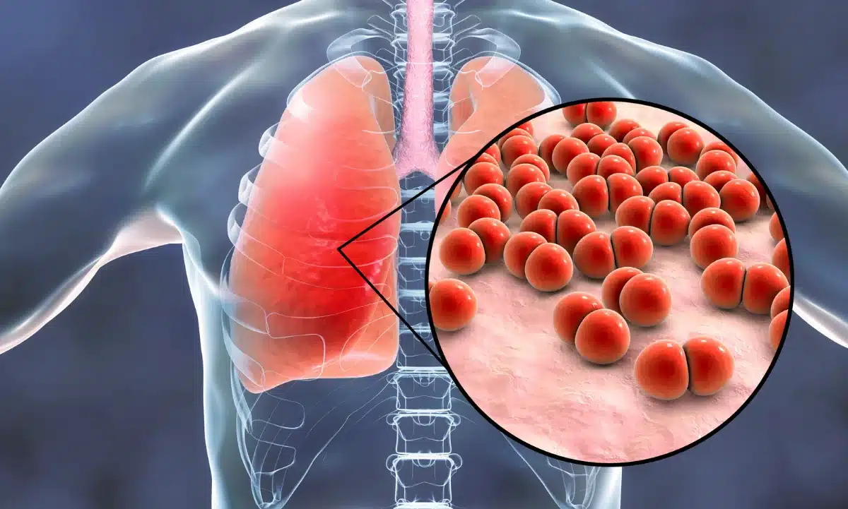 esta bacteria puede dañar gravemente la salud